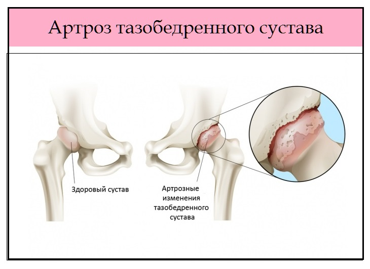       - KinesioPro